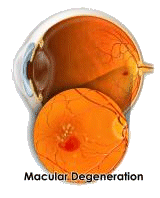 ARMD in the eye