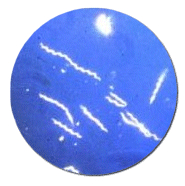 Borrelia burgdorferi spirochete